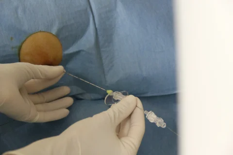 Biopsie e procedure diagnostiche