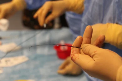 Intervento di embolizzazione in corso in sala operatoria Medico che esegue un intervento di embolizzazione in sala operatoria con catetere inserito nel vaso sanguigno.