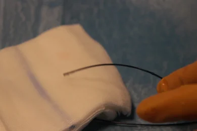 Sala operatoria per embolizzazione con monitoraggio ecografico. Sala operatoria con radiologo e strumenti per embolizzazione, monitorando la posizione del catetere