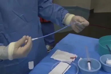 Medici in sala operatoria per drenaggio biliare Medici eseguono un drenaggio biliare sotto guida ecografica per trattare un'ostruzione delle vie biliari.